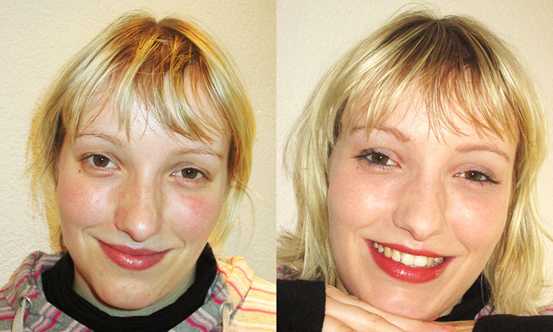 Vorher-Nachher Kosmetikstudio Radeberg